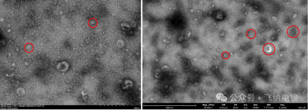 左：外泌体（TEM）；右：外泌体（Pharos STEM）